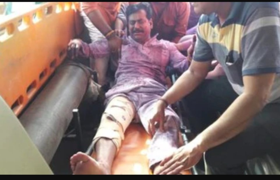 यूपी में गुंडाराज, खीरी में BJP विधायक योगेश वर्मा को गोली मारी, सनसनी