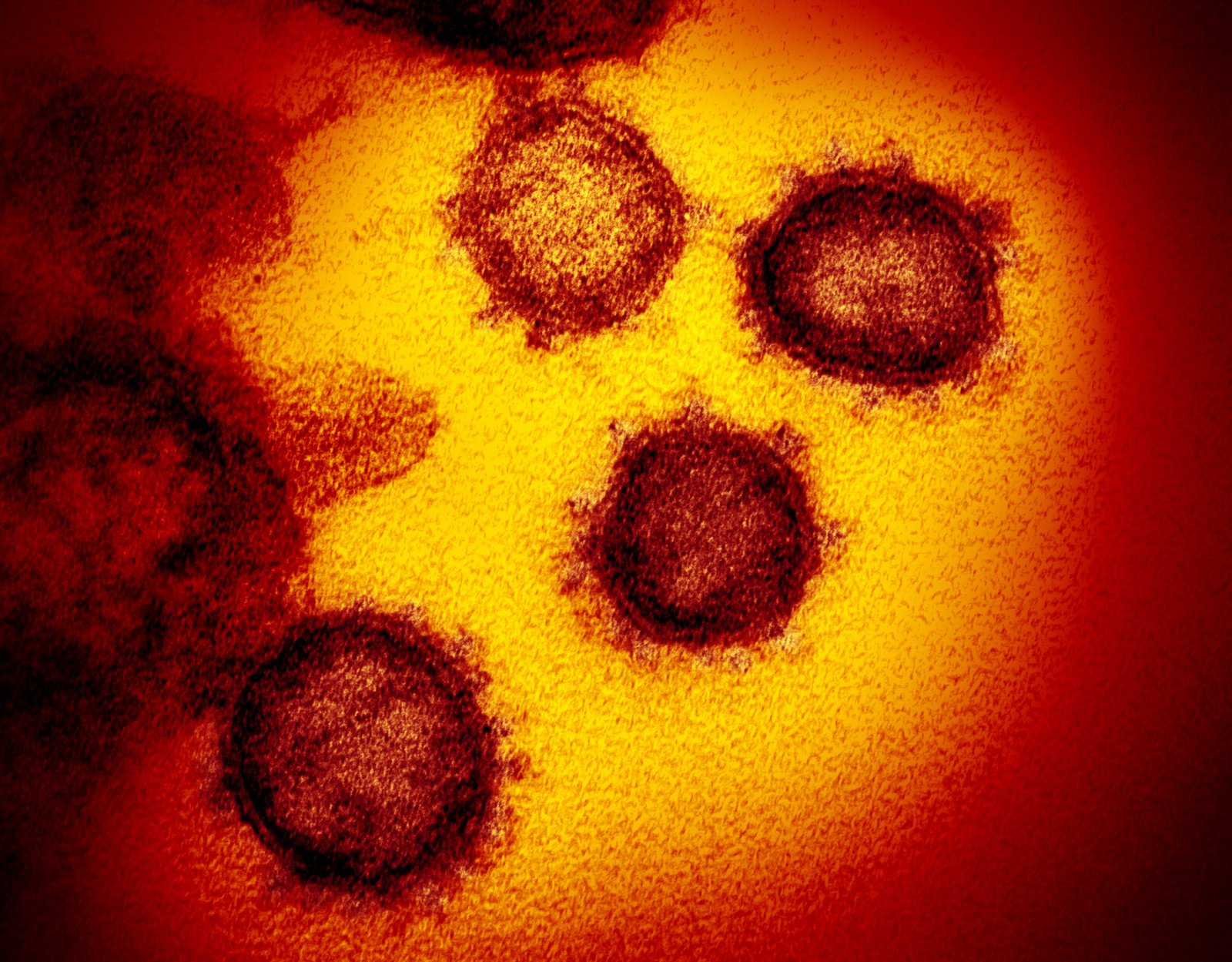 अब तक कोरोना से दुनिया में 372,000 लोग संक्रमित, 16,000 मौत : WHO