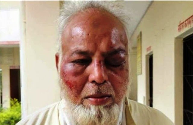 मोदी जिंदाबाद न बोलने पर राजस्थान में बुजुर्ग ऑटो ड्राइवर को पीटा, आरोपी गिरफ्तार